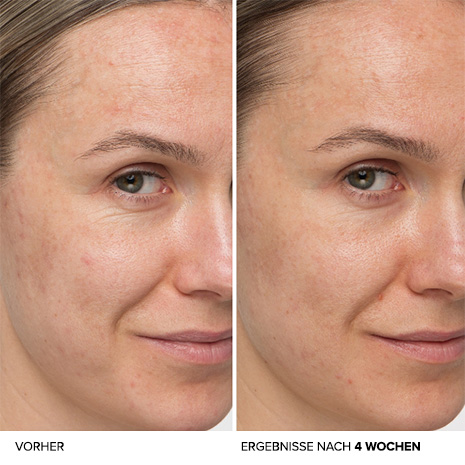 It Cosmetics Confidence in a cream anti-aging Vorher und nachher